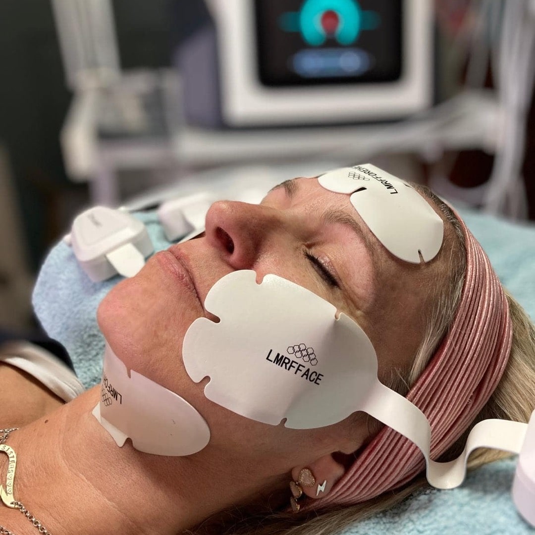 Microcurrent and RF facial treatment being performed with 3D Lift technology at Sculpted Skincare.